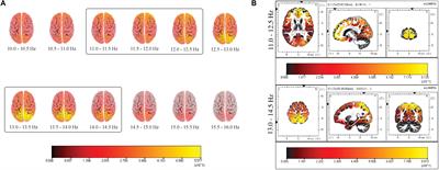 Spatiotemporal Dynamics of Sleep Spindle Sources Across NREM Sleep Cycles